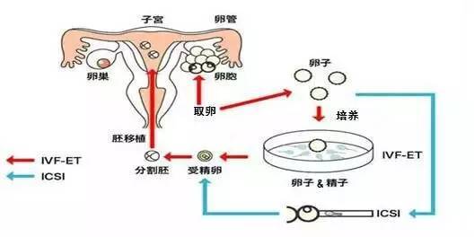 上海是国际化大都市，医疗技术和资源都比较先进和丰富。做试管婴儿需要先进的医疗技术和设备，以及专业的医疗团队。上海拥有这些条件，所以很多人选择在上海做试管婴儿。